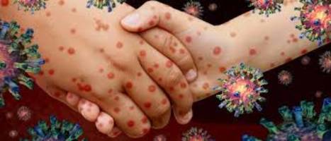 Top 20 Contagious Diseases